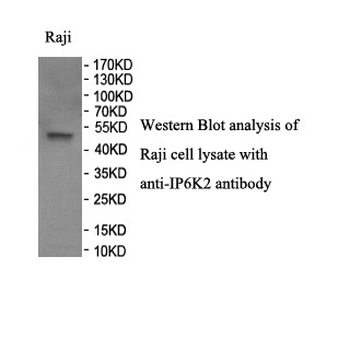 IP6K2 Rabbit Polyclonal Antibody