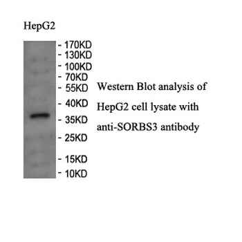 SORBS3 Rabbit Polyclonal Antibody