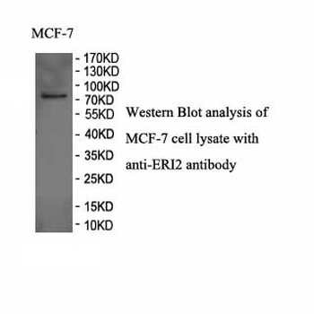 ERI2 Rabbit Polyclonal Antibody