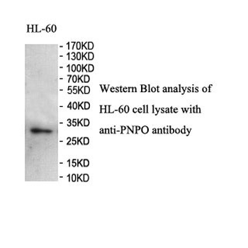 PNPO Rabbit Polyclonal Antibody