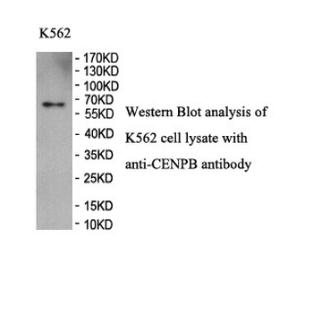 CENPB Rabbit Polyclonal Antibody