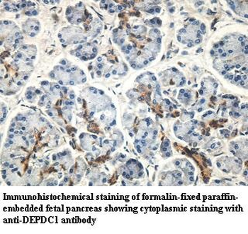 DEPDC1 Rabbit Polyclonal Antibody