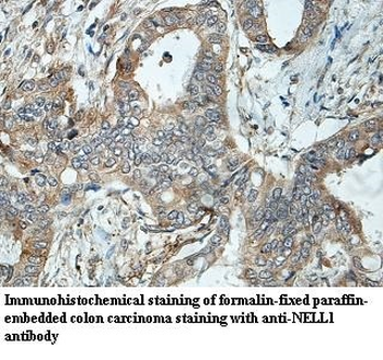 NELL1 Rabbit Polyclonal Antibody