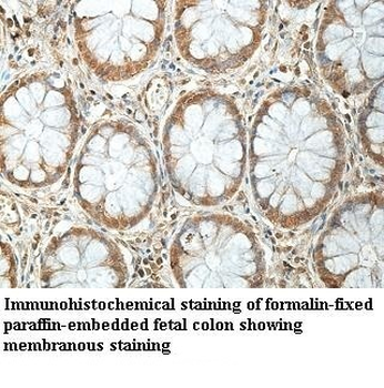 BCMO1 Rabbit Polyclonal Antibody