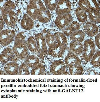 GALNT12 Rabbit Polyclonal Antibody