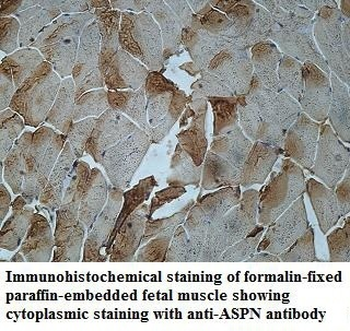 ASPN Rabbit Polyclonal Antibody