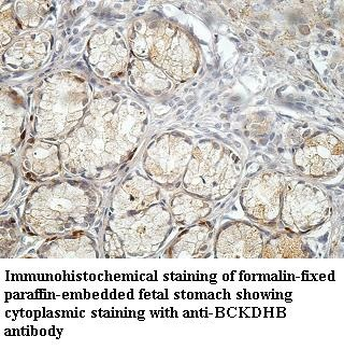 BCKDHB Rabbit Polyclonal Antibody