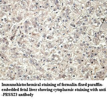 PRSS23 Rabbit Polyclonal Antibody