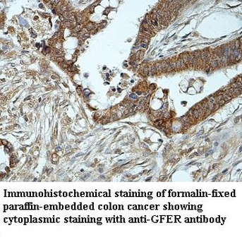 GFER Rabbit Polyclonal Antibody