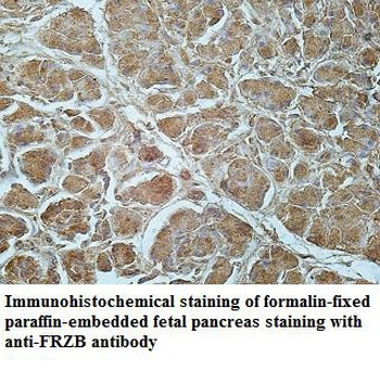 FRZB Rabbit Polyclonal Antibody