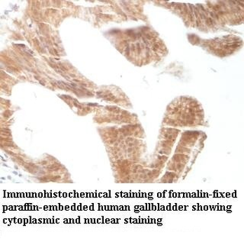 C1orf112 Rabbit Polyclonal Antibody
