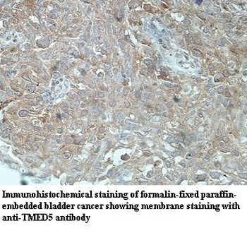 TMED5 Rabbit Polyclonal Antibody