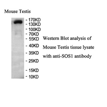 SOS1 Rabbit Polyclonal Antibody