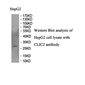CLIC2 Rabbit Polyclonal Antibody