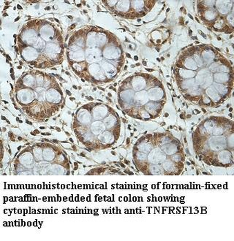 TNFRSF13B Rabbit Polyclonal Antibody