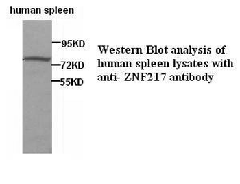 ZNF217 Rabbit Polyclonal Antibody