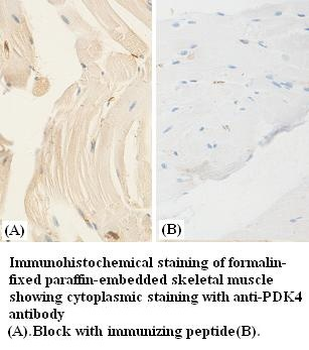 PDK4 Rabbit Polyclonal Antibody