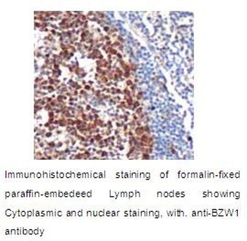 BZW1 Rabbit Polyclonal Antibody
