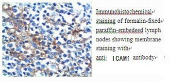 ICAM1 Rabbit Polyclonal Antibody