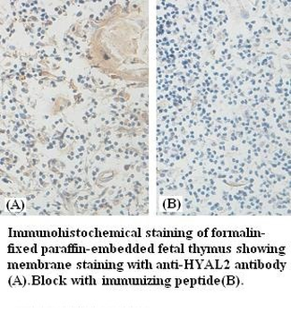HYAL2 Rabbit Polyclonal Antibody