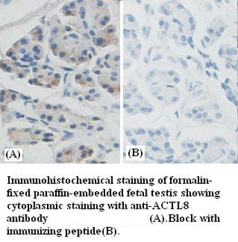 ACTL8 Rabbit Polyclonal Antibody