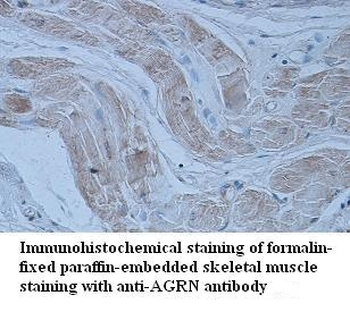 AGRN Rabbit Polyclonal Antibody