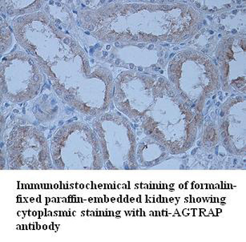 AGTRAP Rabbit Polyclonal Antibody