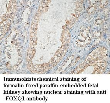 FOXQ1 Rabbit Polyclonal Antibody