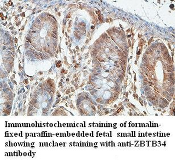 ZBTB34 Rabbit Polyclonal Antibody