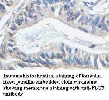 FLT3 Rabbit Polyclonal Antibody