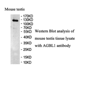 AGBL1 Rabbit Polyclonal Antibody