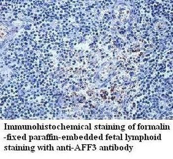AFF3 Rabbit Polyclonal Antibody