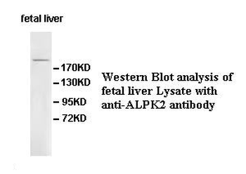 ALPK2 Rabbit Polyclonal Antibody