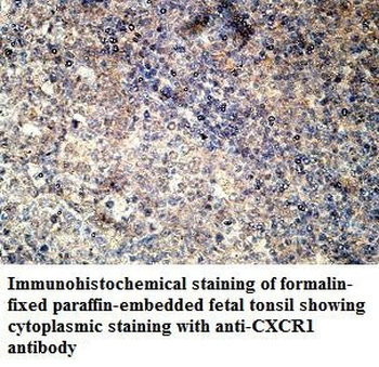 CXCR1 Rabbit Polyclonal Antibody