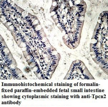 TPCN2 Rabbit Polyclonal Antibody