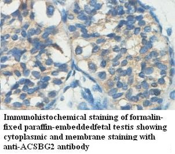 ACSBG2 Rabbit Polyclonal Antibody