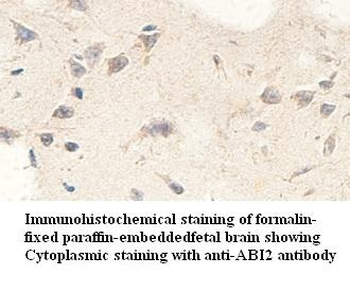 ABI2 Rabbit Polyclonal Antibody