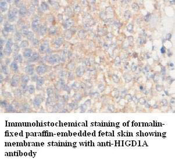 HIGD1A Rabbit Polyclonal Antibody