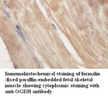 OGDH Rabbit Polyclonal Antibody