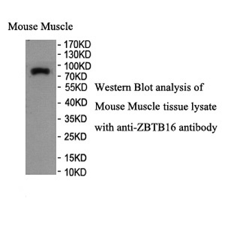 ZBTB16 Rabbit Polyclonal Antibody