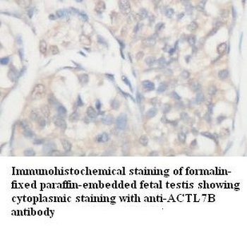 ACTL7B Rabbit Polyclonal Antibody