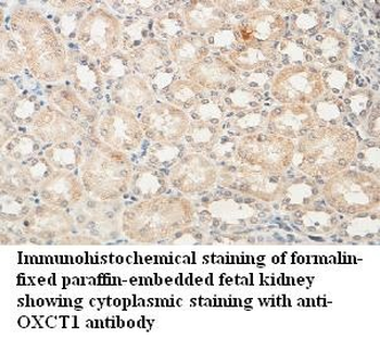 OXCT1 Rabbit Polyclonal Antibody