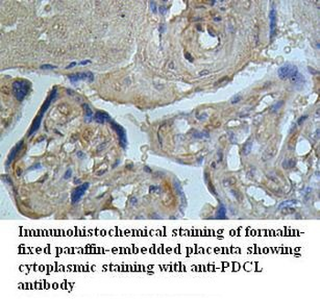 PDCL Rabbit Polyclonal Antibody