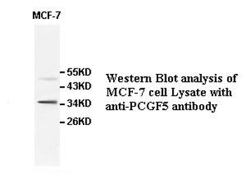 PCGF5 Rabbit Polyclonal Antibody
