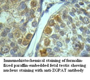 ZGPAT Rabbit Polyclonal Antibody