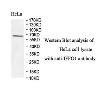 IFFO1 Rabbit Polyclonal Antibody