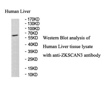 ZKSCAN3 Rabbit Polyclonal Antibody
