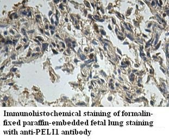 PELI1 Rabbit Polyclonal Antibody