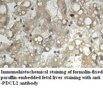 PDCL2 Rabbit Polyclonal Antibody
