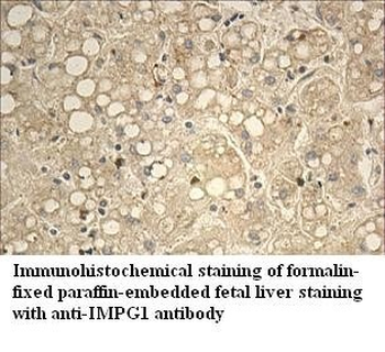 IMPG1 Rabbit Polyclonal Antibody